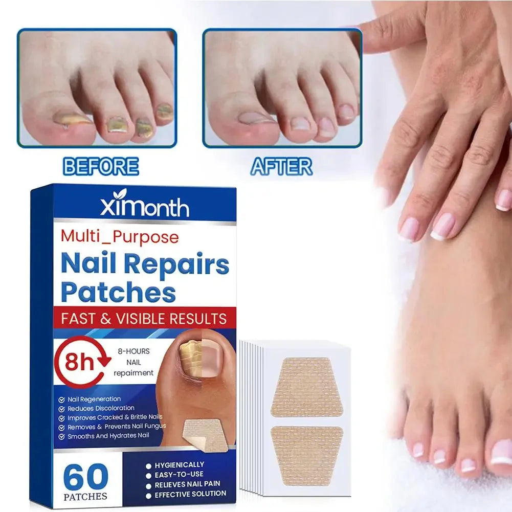 Unauffällige Reparaturpflaster für Nagelpilz — Bild 3